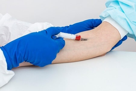 extraccion de sangre para hemograma