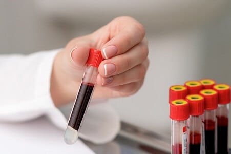 pruebas para la anemia precio